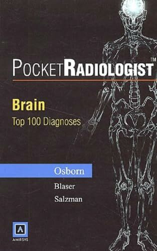 Brain: Top 100 Diagnoses (Pocket Radiologist)