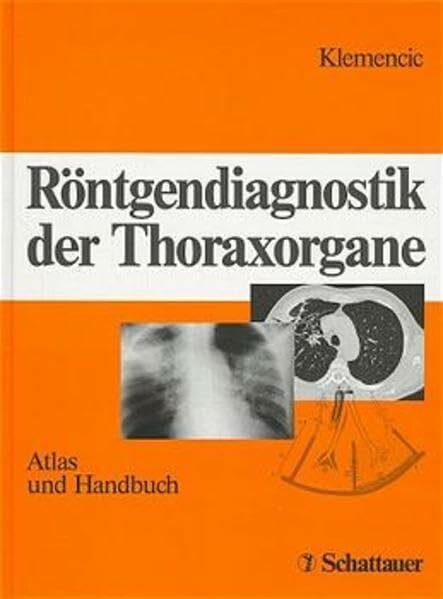 Röntgendiagnostik der Thoraxorgane: Atlas und Handbuch Röntgendiagnostik der Thoraxorgane: Atlas und Handbuch