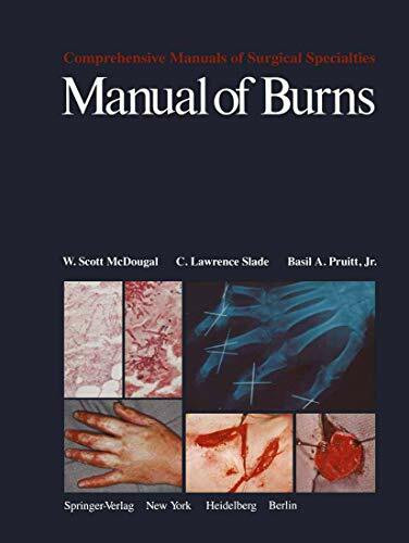 Springer Manual Of Burns (Comprehensive Manuals Of Surgical Specialties)