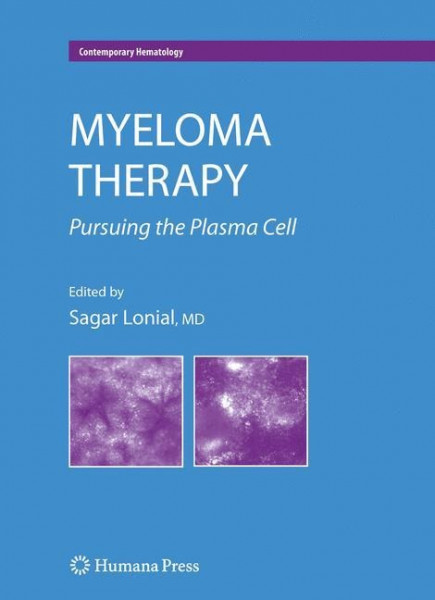 Myeloma Therapy:
