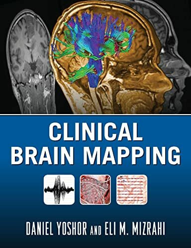 Clinical Brain Mapping (Medicina)