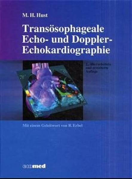 Transösophageale Echo- u. Doppler-Echokardiographie