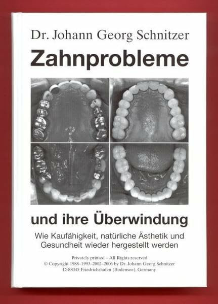 Zahnprobleme und ihre Überwindung: Wie Kaufähigkeit, natürliche Ästhetik und Gesundheit wieder hergestellt werden