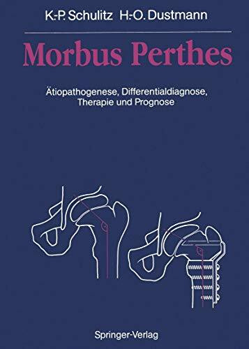 Morbus Perthes: Ätiopathogenese, Differentialdiagnose, Therapie und Prognose