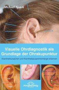 Visuelle Ohrdiagnostik als Grundlage der Ohrakupunktur