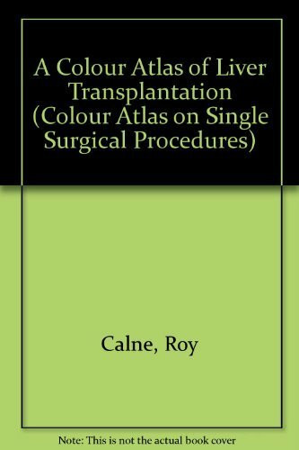 A Colour Atlas of Liver Transplantation (Colour Atlas on Single Surgical Procedures S., Band 27)
