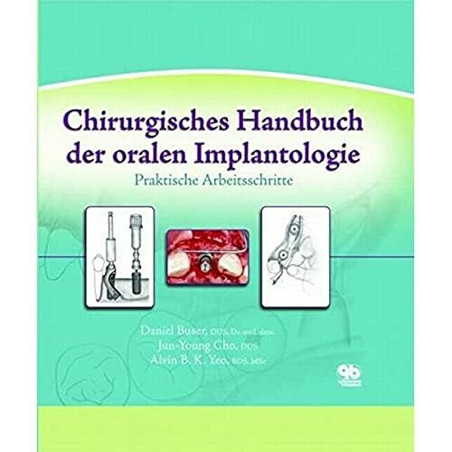 Chirurgisches Handbuch der oralen Implantologie: Praktische Arbeitsschritte