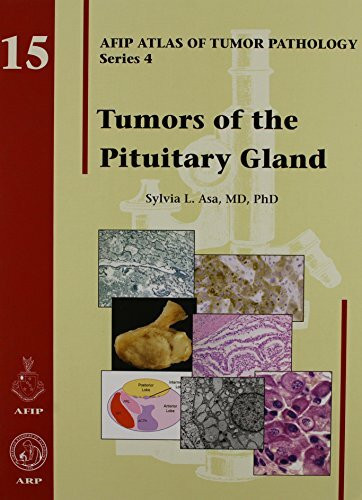 Tumors of the Pituitary Gland: AFIP Atlas of Tumor Pathology, Series 4