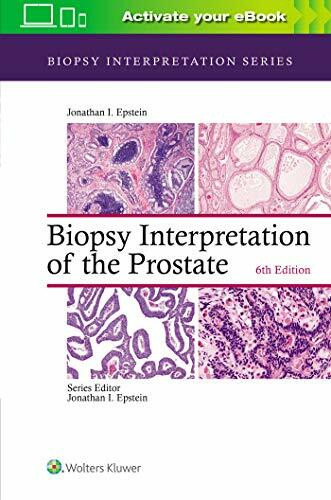 Biopsy Interpretation of the Prostate (Biopsy Interpretation Series)