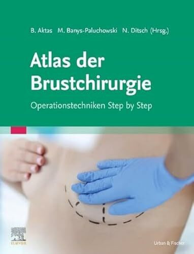 Atlas der Brustchirurgie: Operationstechniken Step by Step