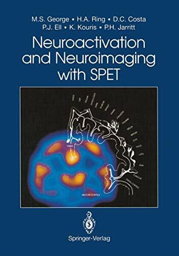 Neuroactivation and Neuroimaging with SPET