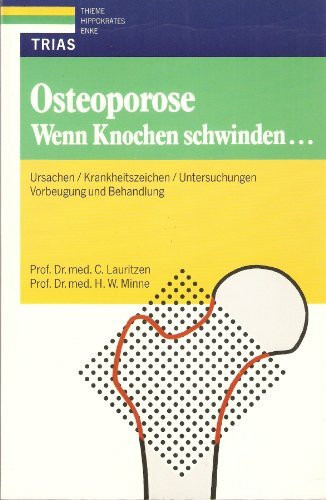 Osteoporose: Wenn Knochen schwinden...: Ursachen, Krankheitszeichen, Untersuchungen. Vorbeugung und Behandlung