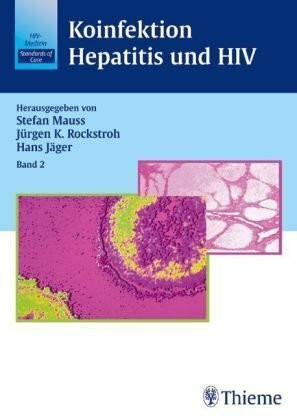 Koinfektion Hepatitis und HIV (Thieme)