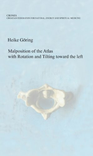 Malposition of the Atlas with Rotation and Tilting toward the left