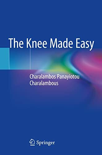 The Knee Made Easy