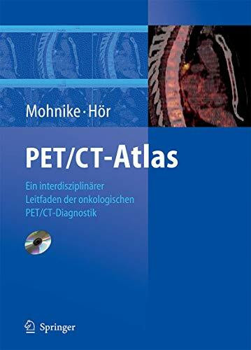 PET/CT-Atlas: Ein interdisziplinärer Leitfaden der onkologischen PET/CT-Diagnostik