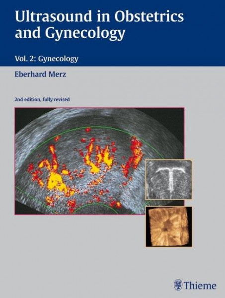 Ultrasound in Obstetrics and Gynecology 2