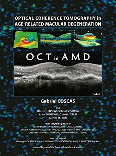 Optical Coherence Tomography in Age-Related Macular Degeneration: OCT in AMD