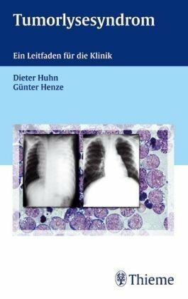 Tumorlysesyndrom: Ein Leitfaden für die Klinik