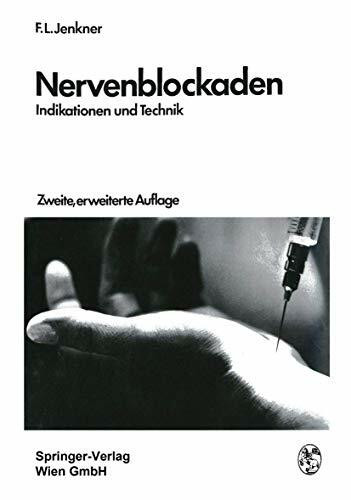 Nervenblockaden: Indikationen und Technik