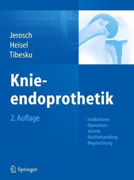 Knieendoprothetik