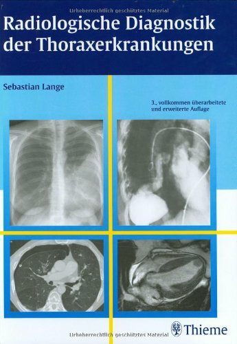 Radiologische Diagnostik der Thoraxerkrankungen