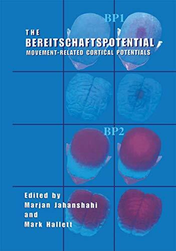 The Bereitschaftspotential: Movement-Related Cortical Potentials