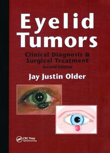 Eyelid Tumors: Clinical Diagnosis and Surgical Treatment