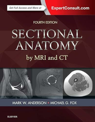 Sectional Anatomy by MRI and CT