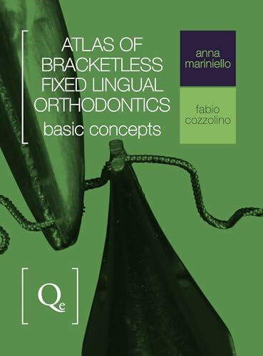 Atlas of Bracketless Fixed Lingual Orthodontics: Basic Concepts