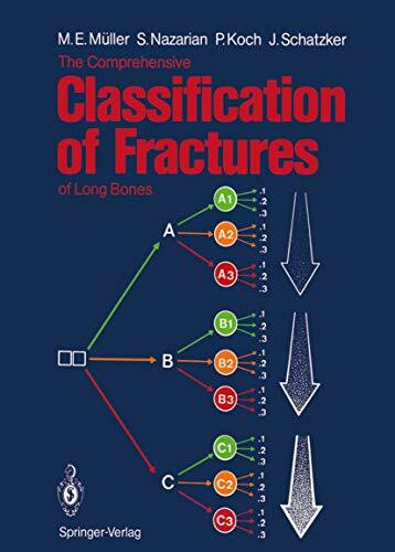 The Comprehensive Classification of Fractures of Long Bones