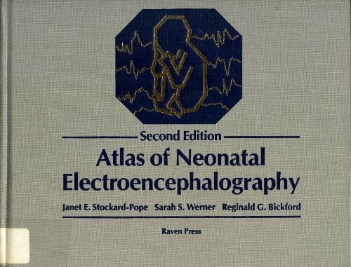 Atlas of Neonatal Electroencephalography
