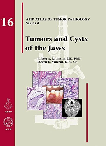 Tumors and Cysts of the Jaws (AFIP Atlas of Tumor Pathology, Band 4)