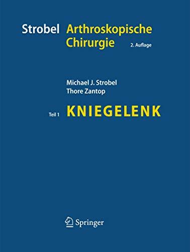Strobel Arthroskopische Chirurgie: Teil I: Kniegelenk Strobel Arthroskopische Chirurgie: Teil I: Kniegelenk