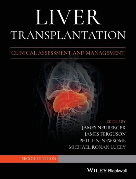 Liver Transplantation