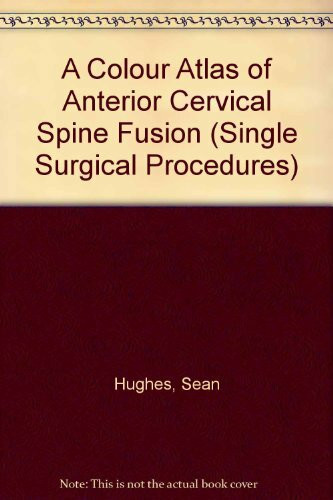 A Colour Atlas of Anterior Cervical Spine Fusion (Single Surgical Procedures, Band 26)