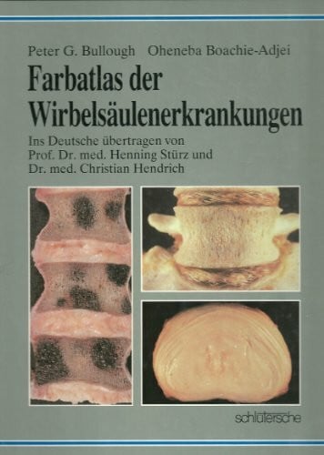 Farbatlas der Wirbelsäulenerkrankungen