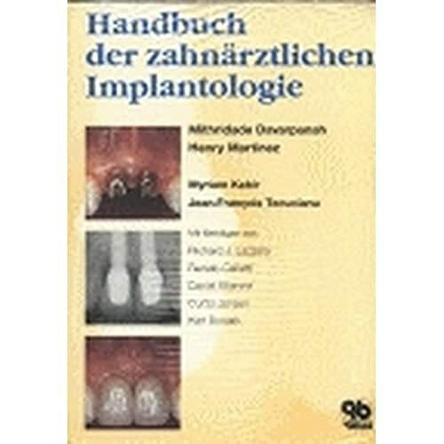 Handbuch der zahnärztlichen Implantologie