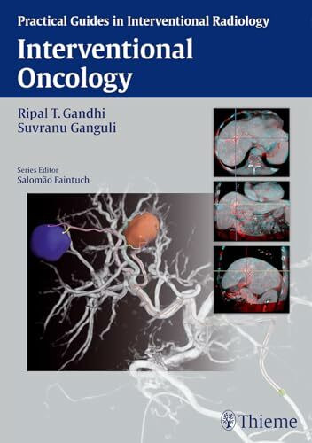 Interventional Oncology (Practical Guides in Interventional Radiology)