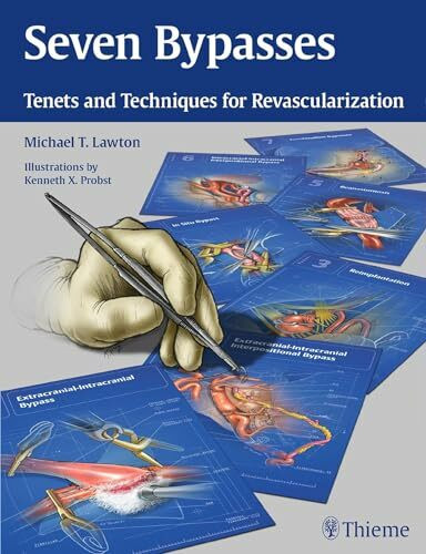 Seven Bypasses: Tenets and Techniques for Revascularization
