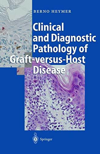 Clinical and Diagnostic Pathology of Graft-versus-Host Disease