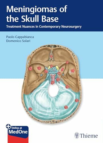 Meningiomas of the Skull Base: Treatment Nuances in Contemporary Neurosurgery. Plus Online at MedOne Meningiomas of the Skull Base: Treatment Nuances in Contemporary Neurosurgery. Plus Online at MedOne