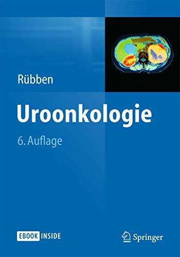 Uroonkologie