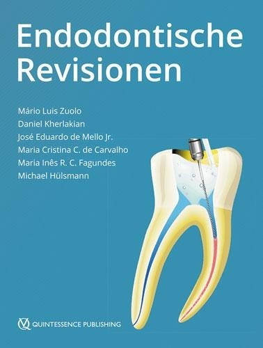 Endodontische Revisionen