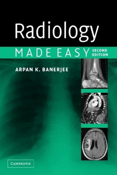 Radiology Made Easy, Second Edition