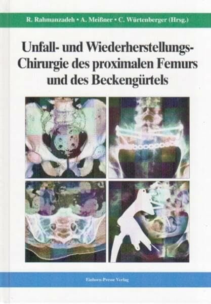 Unfall- und Wiederherstellungs-Chirurgie des proximalen Femurs und des Beckengürtels Unfall- und Wiederherstellungs-Chirurgie des proximalen Femurs und des Beckengürtels