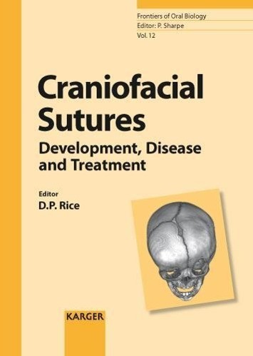 Craniofacial Sutures
