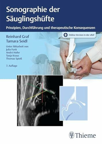 Sonographie der Säuglingshüfte: Prinzipien, Durchführung und therapeutische Konsequenzen