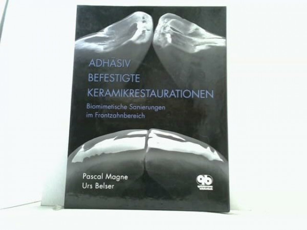 Adhäsiv befestigte Keramikrestaurationen: Biomimetische Sanierungen im Frontzahnbereich