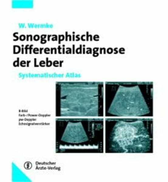 Sonographische Differenzialdiagnose Leberkrankheiten: Systematischer Atlas